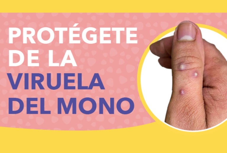 Iglesia se une a campaña de información sobre la viruela del mono